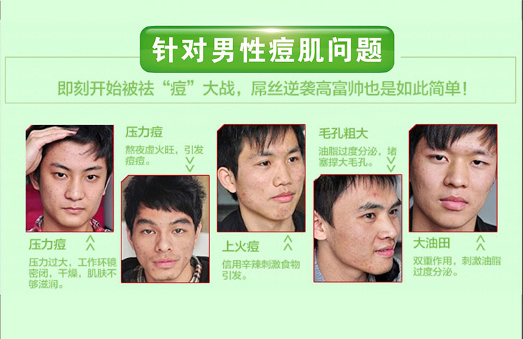 神农故事本草精华液针对男性痘肌问题 神农故事本草精华液针对男性痘肌问题