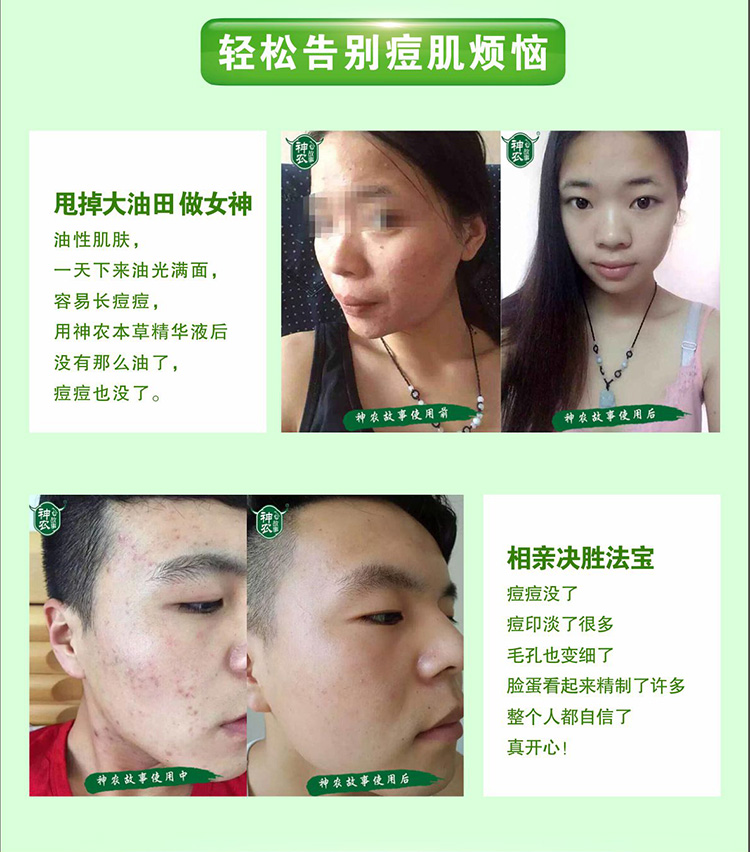 神农故事本草精华液解决油性皮肤问题 神农故事本草精华液解决油性皮肤问题