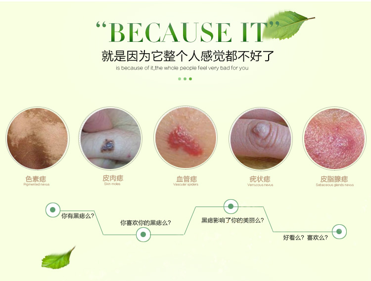 色素痣,皮肉痣,血管痣,疣状痣,皮脂腺痣 色素痣,皮肉痣,血管痣,疣状痣,皮脂腺痣