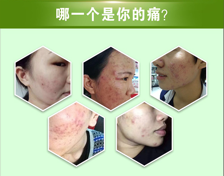 神农故事本草精华液的作用 神农故事本草精华液的作用